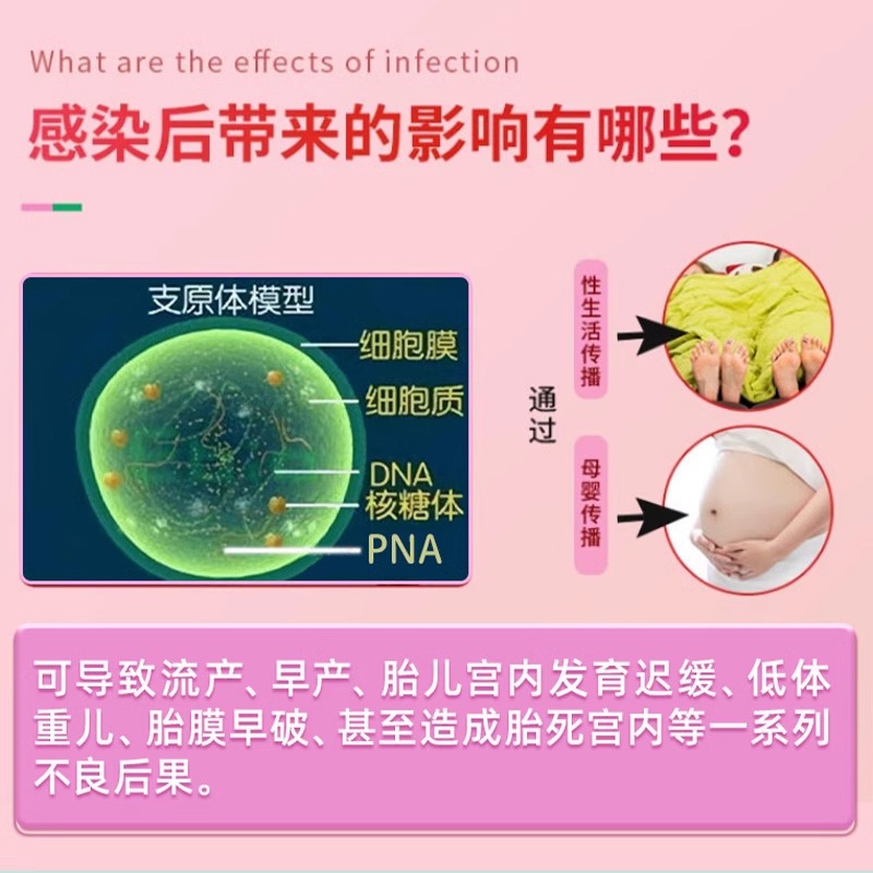 解脲支原体感染妇科药女性尿路感染外用中成药治消疗阴道炎凝胶炎-图2