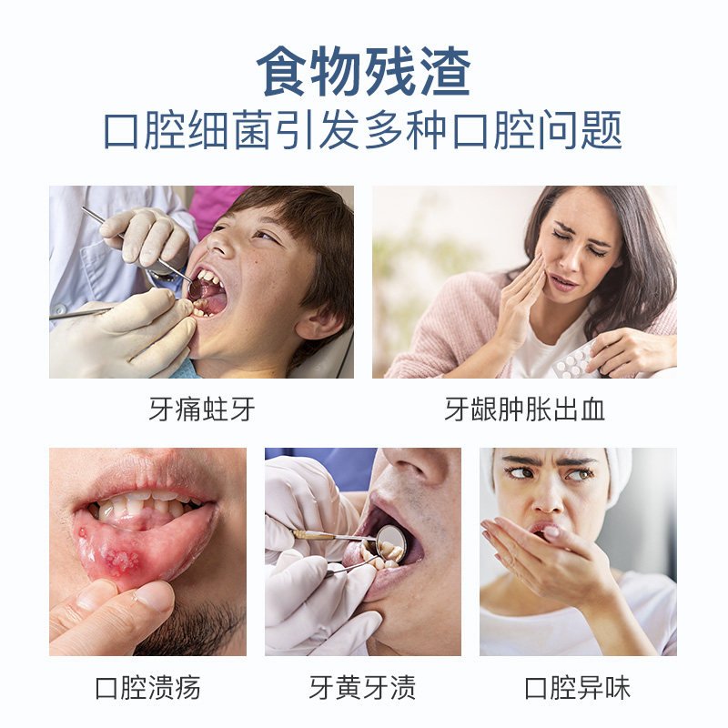 双极水含漱抗菌液益生菌便携漱口水 双水生活漱口水