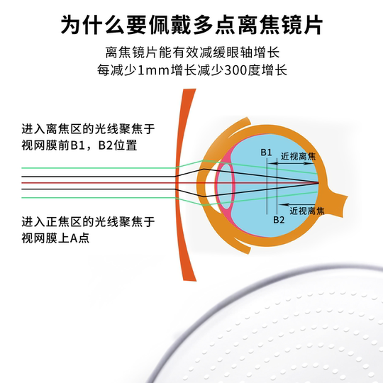 青少年近视多点离焦防控近视眼镜片减缓度数加深星趣控小乐园同款