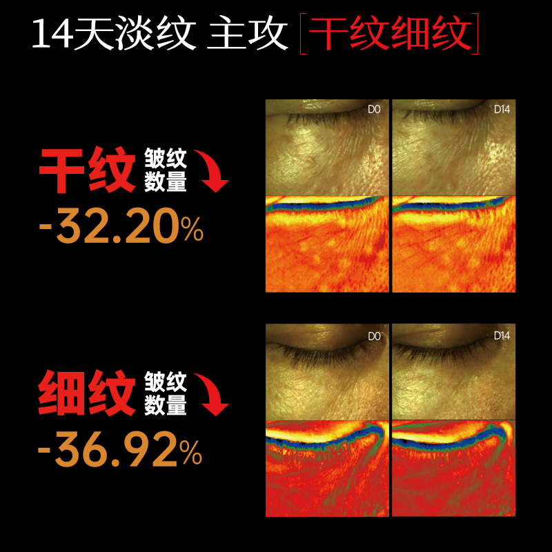 境生之源紧致抗皱水乳套装补水保湿提拉修护舒缓淡纹敏感肌护肤品