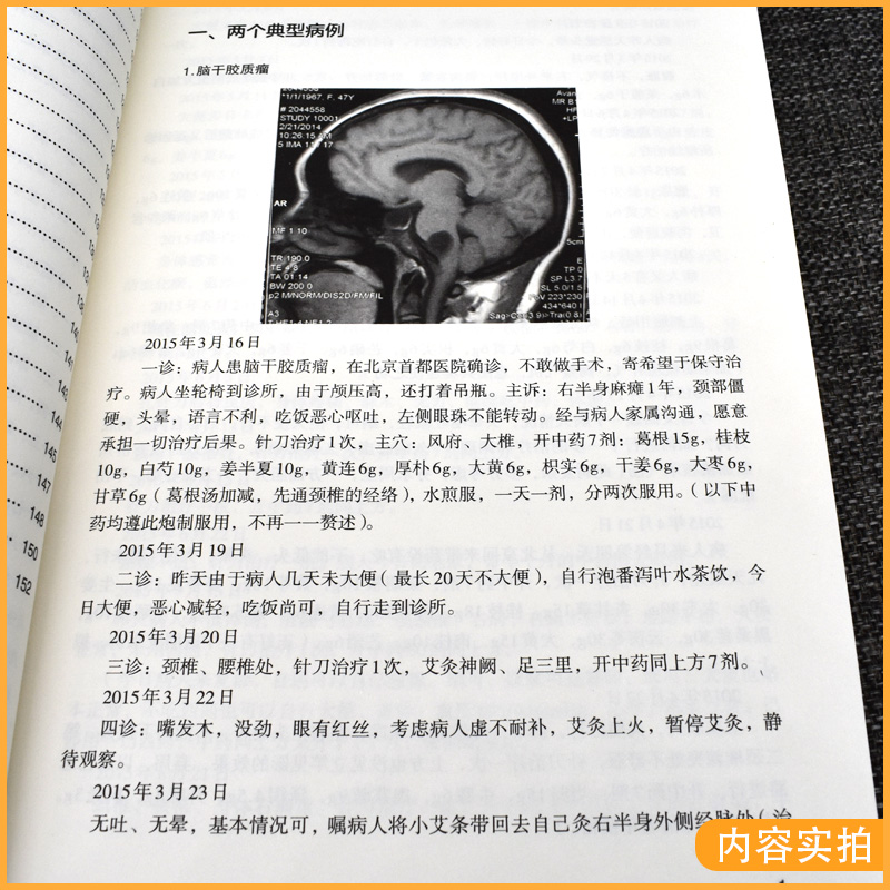 正版书籍针刀临证践行悟录 杨戈主编 9787513262675中国中医药出版社 中医临床 针刀临床实践必读 中医书籍 核心能力提升引导丛书 - 图3