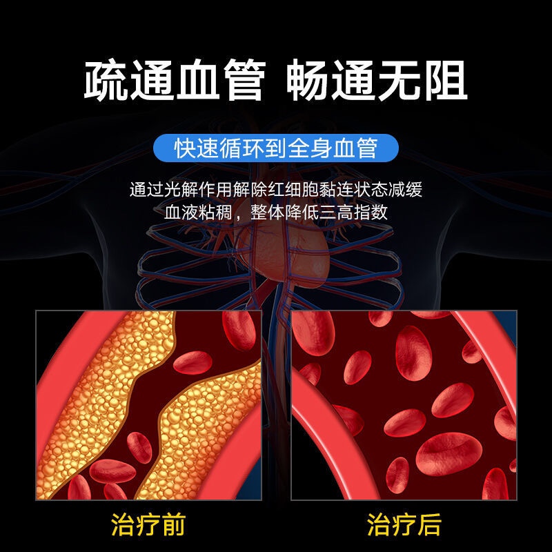 光盾妙医生半导体激光治疗仪心脑血管梗辅仁三高血压脂降血糖手表