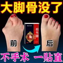 (Large Footed night Shaw) Hallux Valgus Stickler Toe Valgus Corrective God Instrumental Foot Bone Deformation Overlapping Exclusive JL