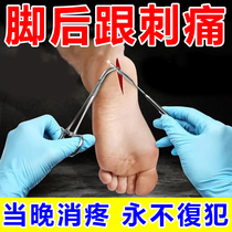 Foot heel pain (night pain) heel sticking heel bone tingling pain standing pain walking pain with special effects paste YF