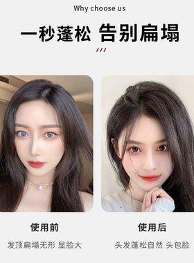 网红头发蓬松神器增高颅顶发夹