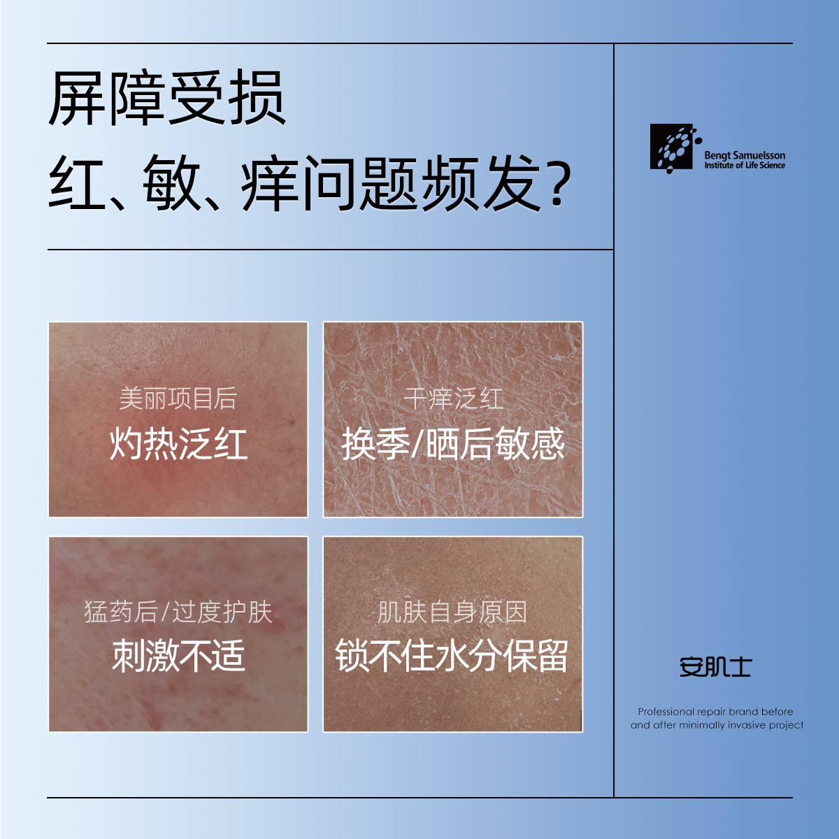 【618狂欢】安肌士贻贝面膜修护屏障补水保湿舒缓敏感肌晒后修护-图3