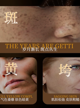 伊华打斑干料*DT美白祛斑冻干粉