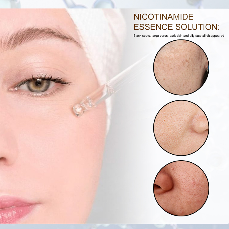 Shrink Pore Face Serum Niacinamide Whitening Fade Dark Spots - 图3