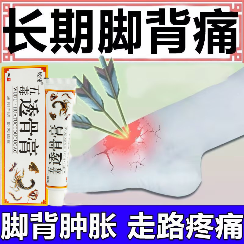 脚背鼓包筋膜焱酸痛肿胀脚踝脚面后跟疼扭拉伤麻木腱鞘肿止疼膏 - 图0