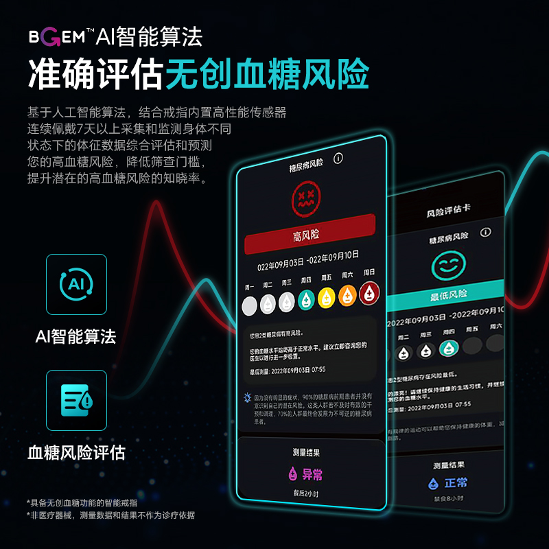 Yijie Smart Ring Blood Glucose Monitoring Ring Sleep