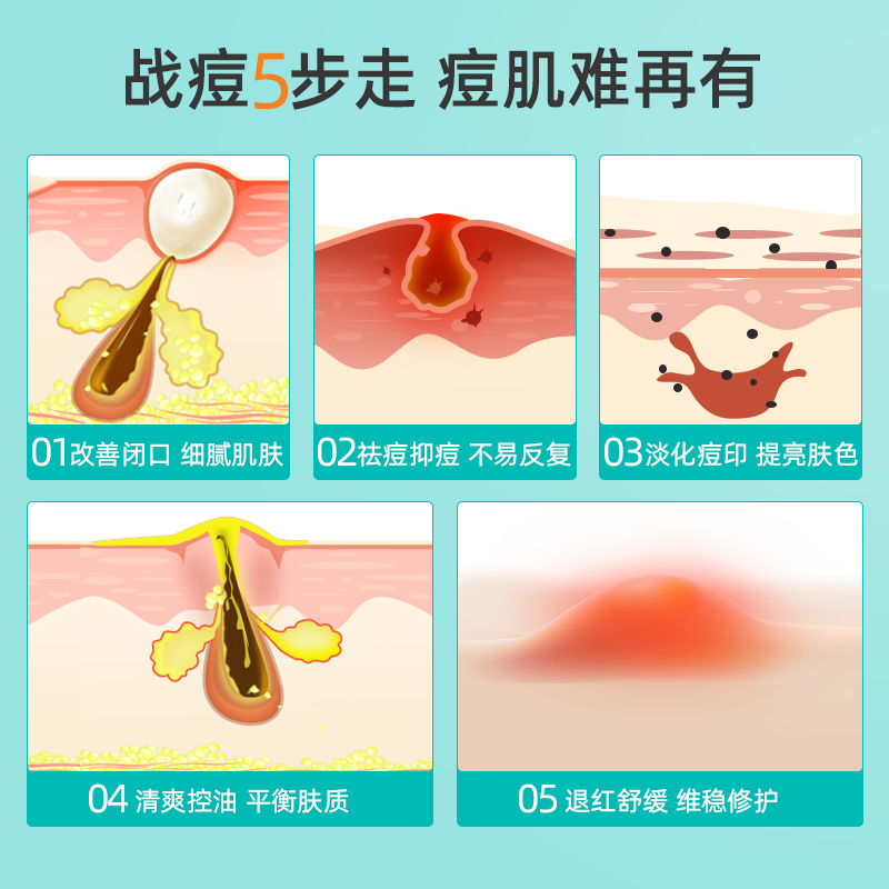 肤纯20%祛痘闭口淡控油凝胶壬二酸 肤纯化妆品乳液/面霜