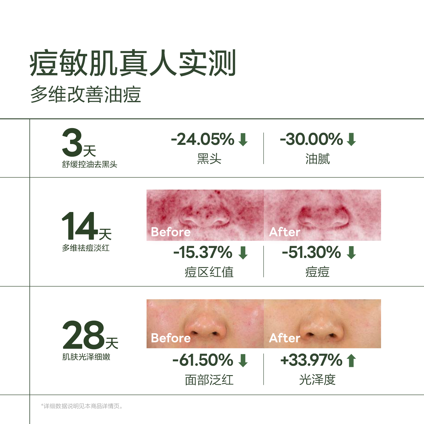 【U先】安敏优青蒿舒缓祛痘淡印控油收缩毛孔去闭口修护精华3支