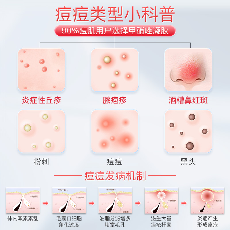 甲硝唑阴道凝胶甲硝唑妇科用官方旗舰店和搭壬二酸祛痘凝胶医用GQ