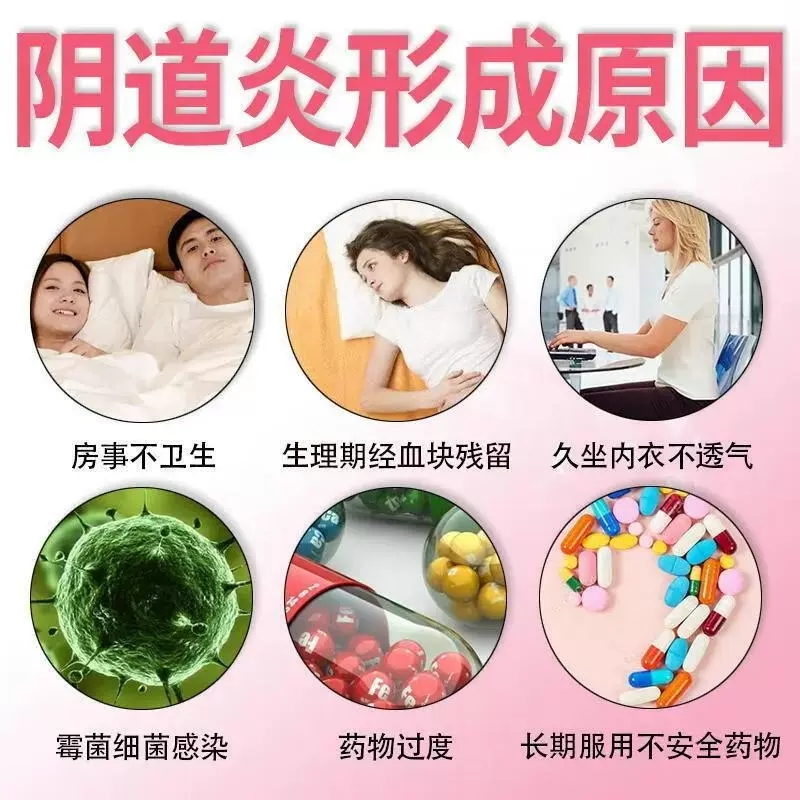 碳酸氢钠片小苏打妇科粉冲洗可搭妇炎康片阴道炎妇科用药泡腾片QD - 图1