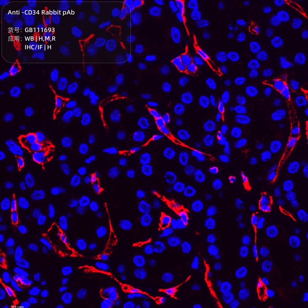 Servicebio抗-CD34兔pAb,Anti-CD34 Rabbit pAb,GB111693,100μL-图1