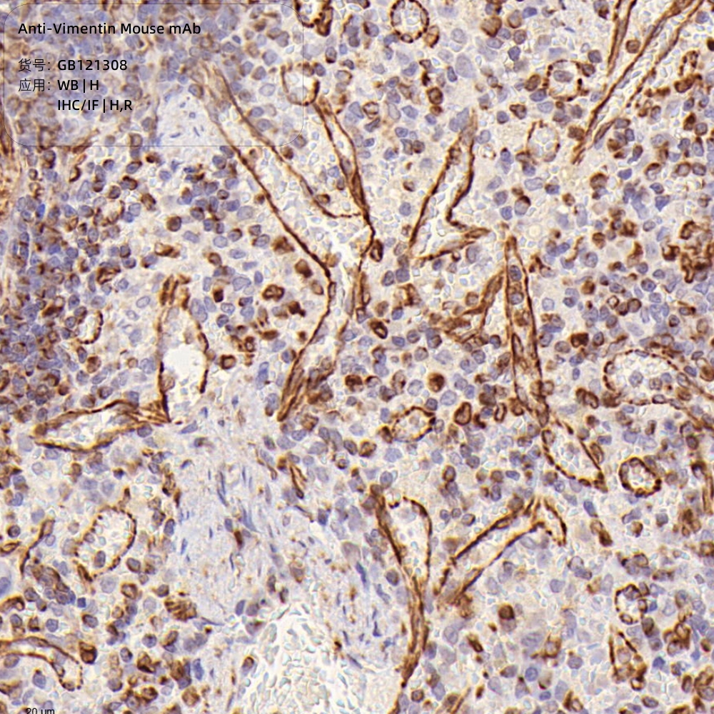 Servicebio抗病毒素小鼠单克隆抗体Anti-Vimentin MousemAb100μL - 图3