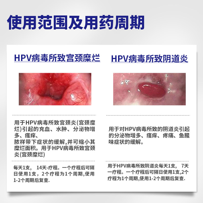  奥维泰克医疗器械私处护理（器械）