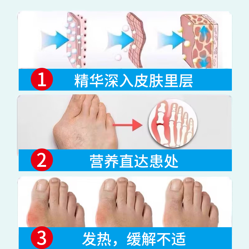 大脚骨女鞋宽脚矫正器拇指外翻脚趾重叠大拇指关节变形专用 - 图1