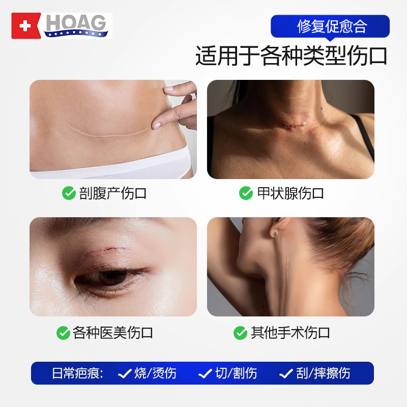 霍格Hoag芭快美生物蛋白修护液愈合恢复伤口剖腹产预防疤痕修复液