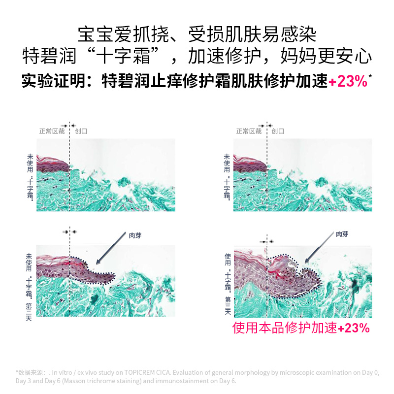 【顺手买】特碧润CICA舒缓乳霜止痒膏蚊虫叮咬消红磕碰修护凝胶5g