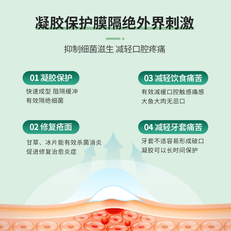 泰国原装进口NIDA戴挪伦口腔膏溃疡膏口腔溃疡专用药嘴巴上火起泡