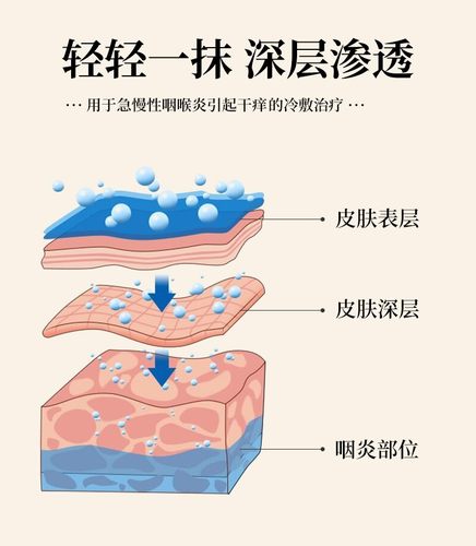 芙顺堂咽扁舒李时珍官方正品专慢性咽炎冷敷凝胶软膏用咽扁清-图2