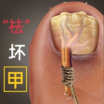 (Little Red Book Referral) Bad A Kstar removes the bad A dead potassium grey potassium grows out of a good A shot.