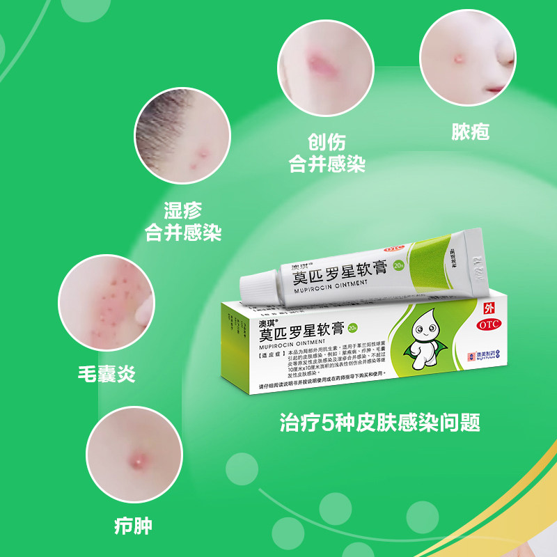 澳美制药澳琪/盒外用莫匹罗星软膏 澳美制药抗菌消炎