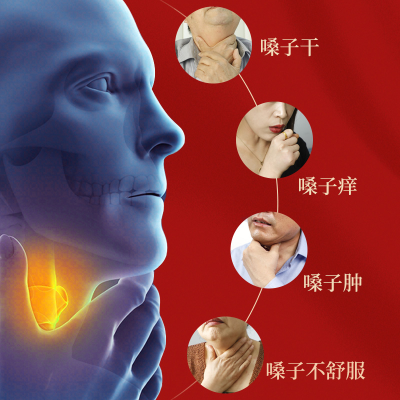 芙顺堂咽扁舒软膏型咽炎慢性咽炎冷敷凝胶除李时珍集团官方正品根 - 图3