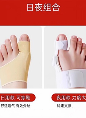 【医师推荐】拇外翻矫正器可穿鞋