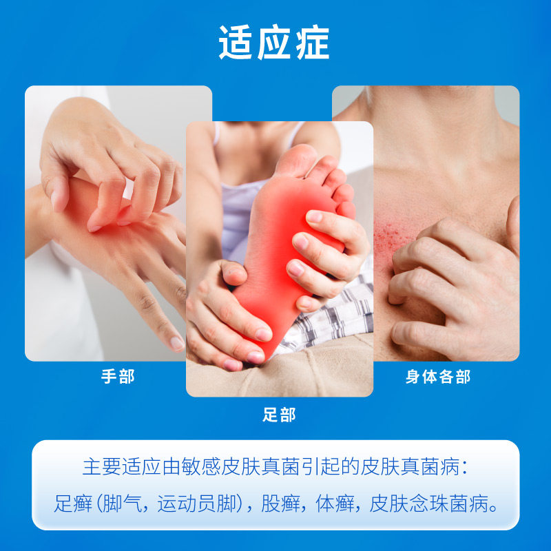 楚迪盐酸阿莫罗芬15g治脚气乳膏 福邦医药癣症