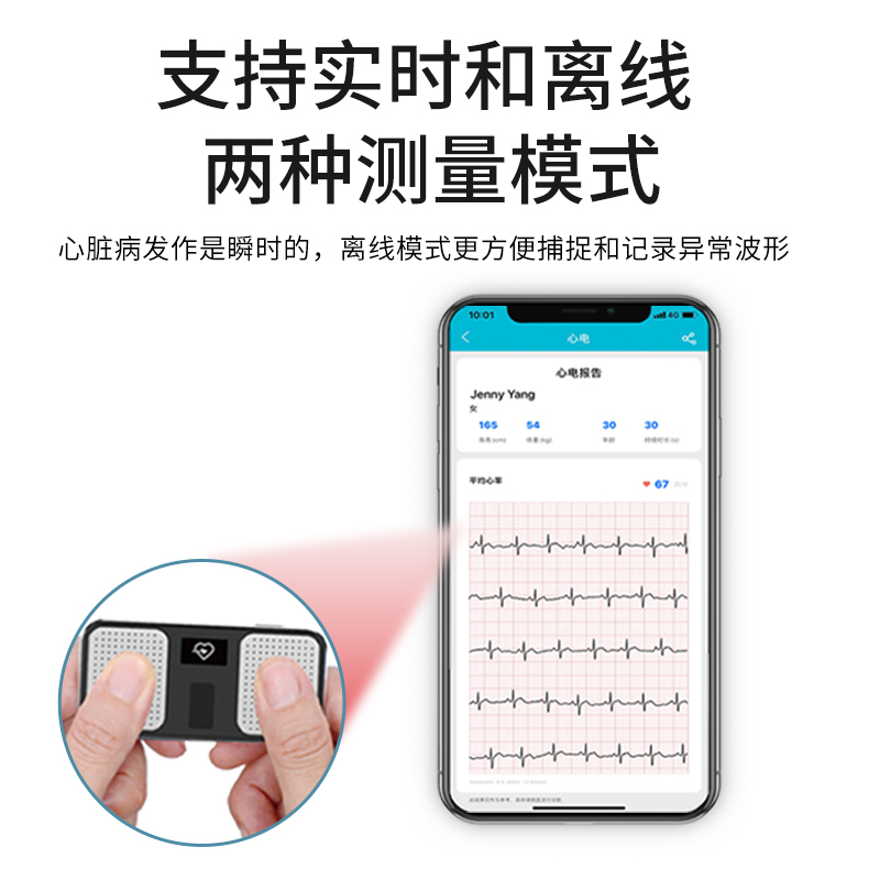 超思无线心电记录仪监护仪医用便携家用心电图监测心脏心率监控器 - 图1