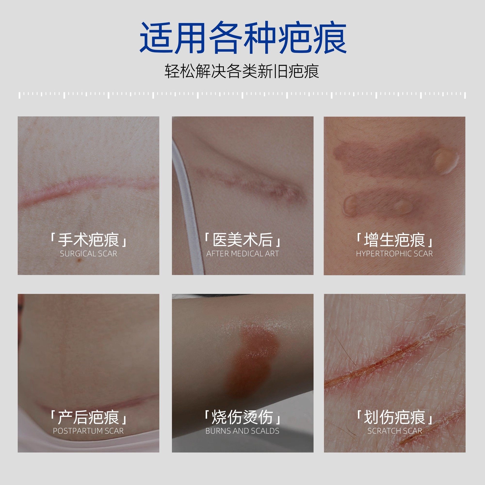 祛疤膏医用硅酮凝胶敷料手术烫伤淡化修复疤痕贴增生凸起除疤产品,淘宝优惠券,粉丝福利购,淘宝优惠卷