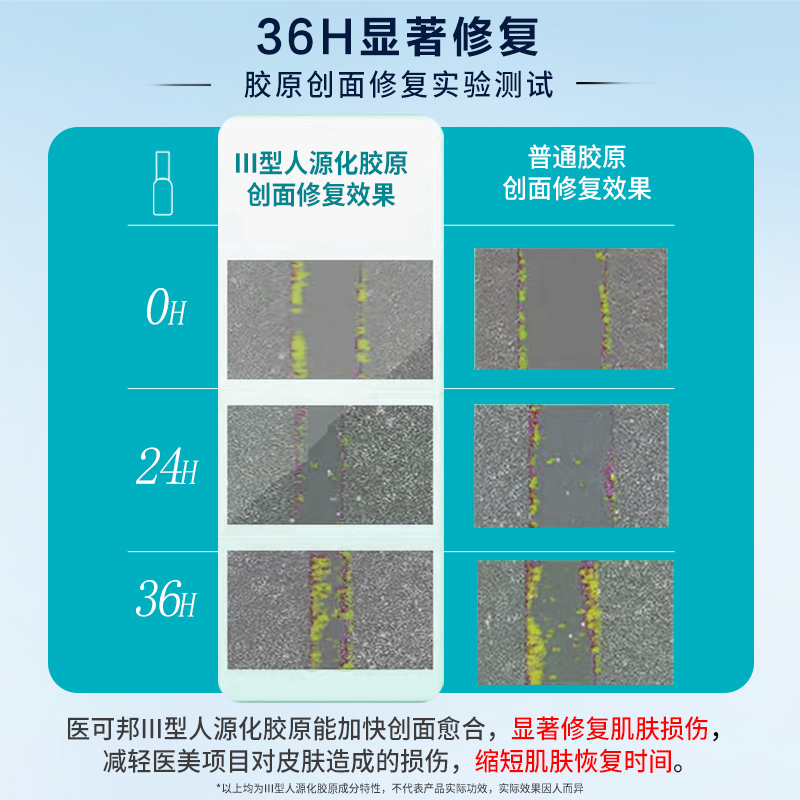 医可邦胶原蛋白修复凝胶淡化疤痕痤疮痘印术后修护医用除疤械字号 - 图3