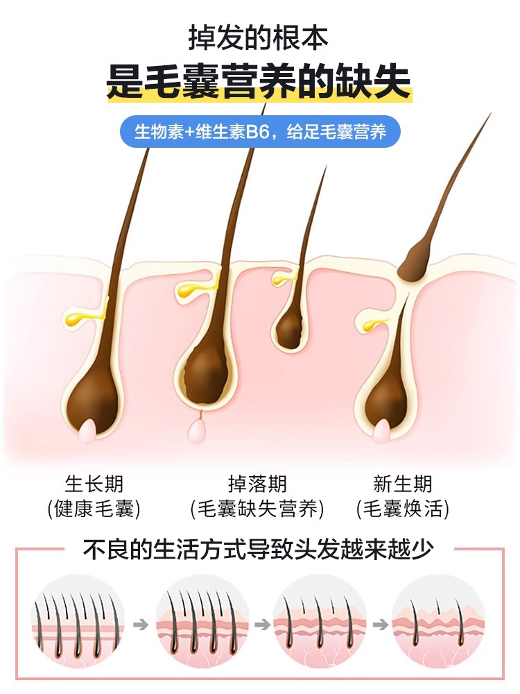 biotin生物素防脱发护发保健品掉头发严重吃什么维生素b7养发正品-图0