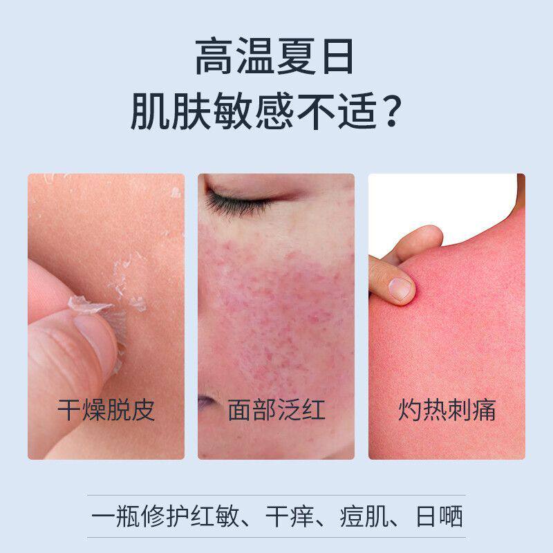 SUMDOY日本进口晒后修复凝胶全身体皮肤芦荟胶舒缓霜脸部晒伤修护