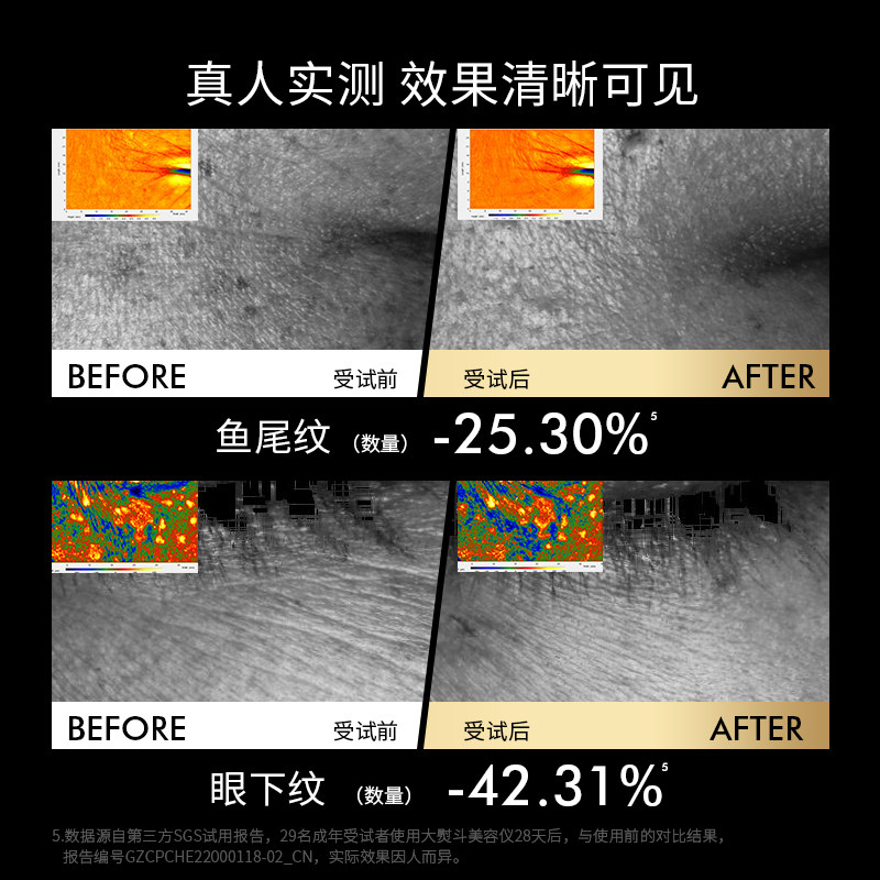 Jmoon极萌电子美容仪