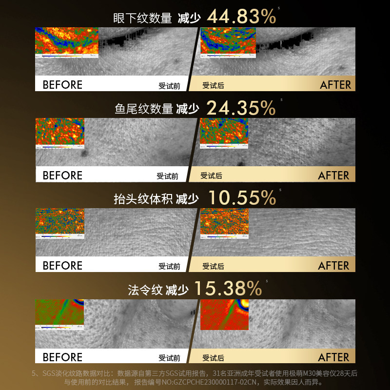  Jmoon极萌电子美容仪