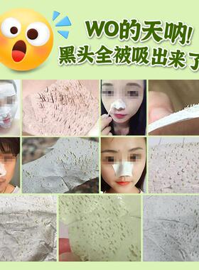 泰国去黑头收缩毛孔粉刺深层清洁神器女男士专用 white祛黑头鼻贴
