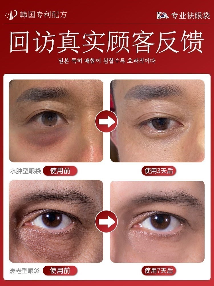 【男士眼袋贴】第三件10元！大眼袋眼纹泪沟黑眼圈眼角纹抚纹修护 - 图1