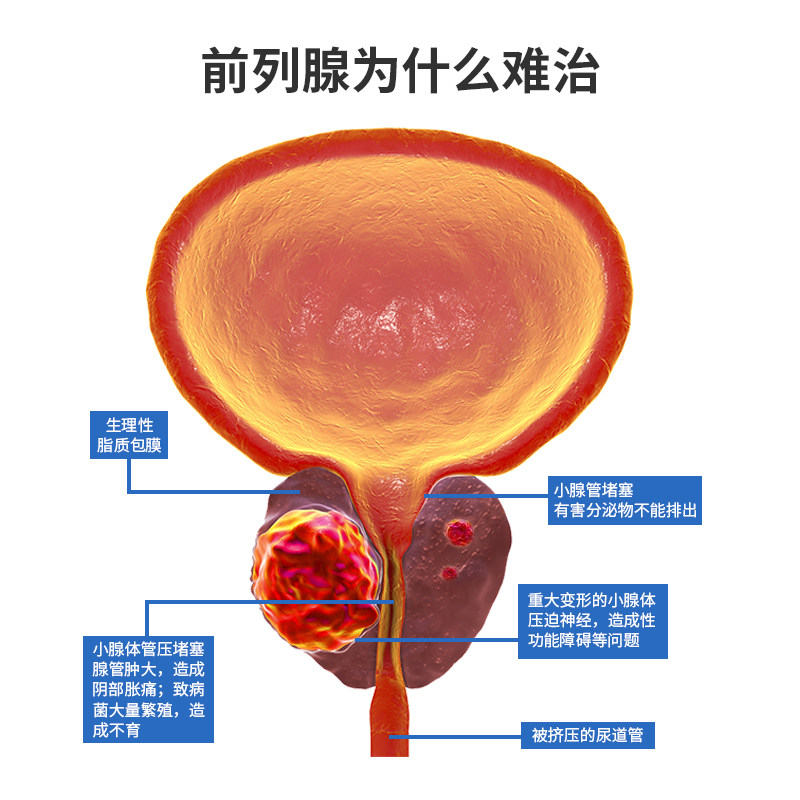  鼻之光理疗仪（器械）
