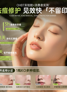 芦荟胶祛痘印坑膏补水保湿晒后修复泛红敏感肌凝胶正品官方旗舰店