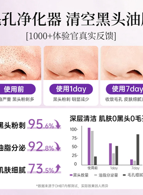 OHBT紫苏泥膜深层清洁毛孔去黑头