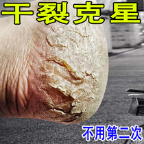 (Dry Crack Star) Amendments Horse Oil Paste One Smear of Foot Tender and Dry Cracked Kstar Frost-proof Crack ZC