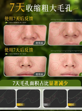 青雨纪OEEU湿敷水控油收缩毛孔