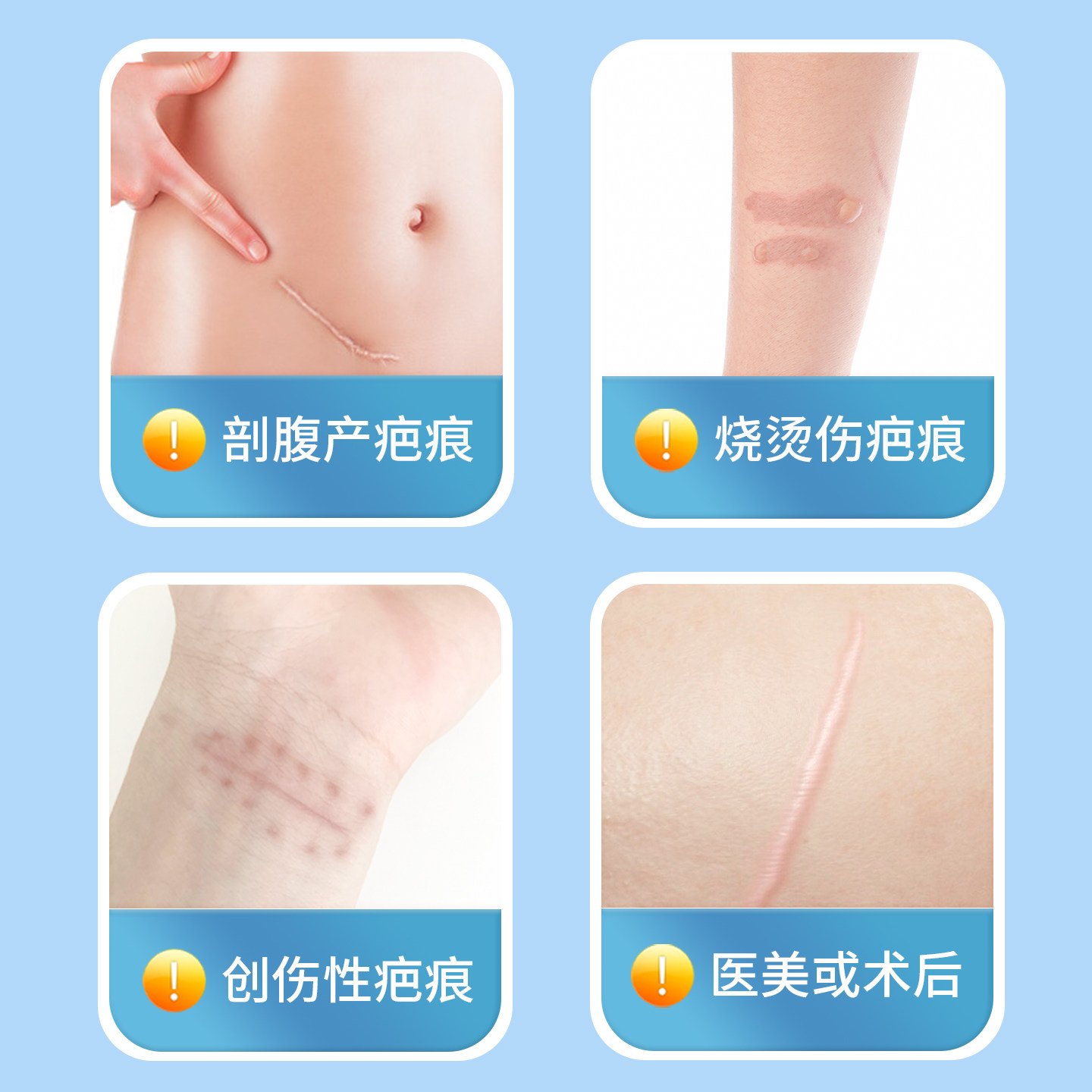 海氏海诺医用疤痕贴减张贴剖腹产硅酮凝胶美肤隐形甲状腺术后遮盖,淘宝优惠券,粉丝福利购,淘宝优惠卷