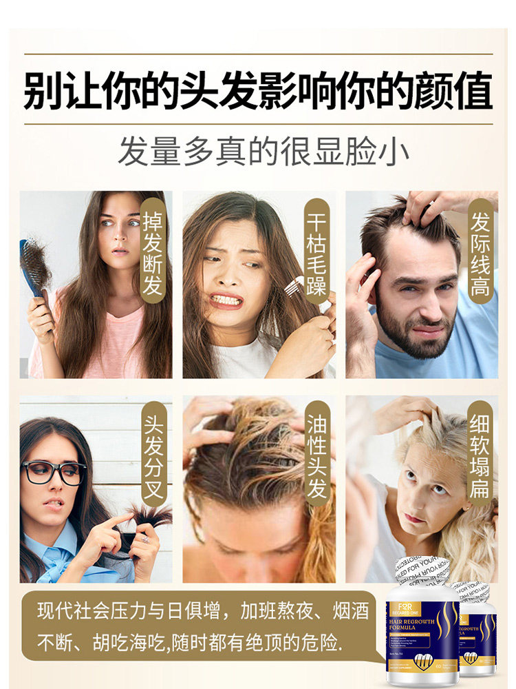 biotin维生素b7产后脱发进口生物素 森棠海外B族维生素