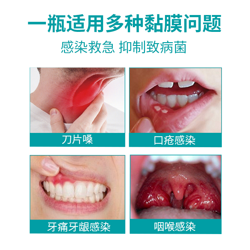 9930消毒液口腔肛黏膜发炎止痒家用消毒液除菌抑菌衣物防感染喷雾 - 图0