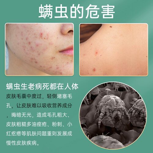 上海药皂硫磺液体香皂抑菌除螨硫磺皂沐浴露洗脸洗发皂通用沐浴皂 - 图0