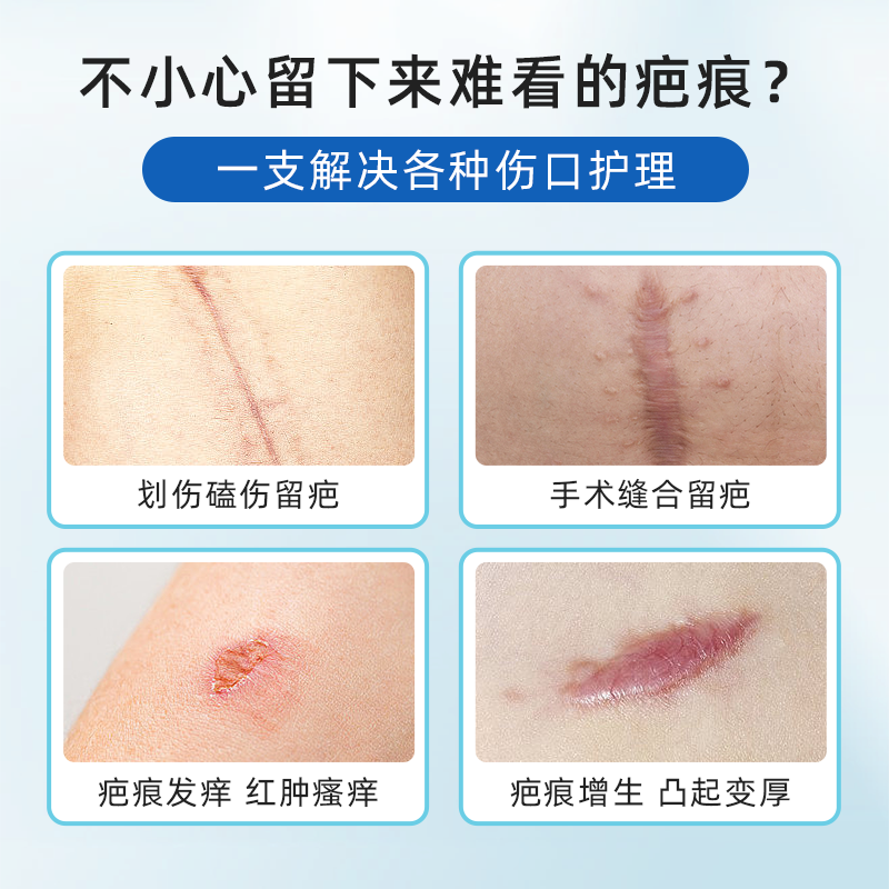 澳洲直邮Bepanthen拜耳贝乐欣祛疤膏硅酮凝胶疤痕修复去疤剖腹产